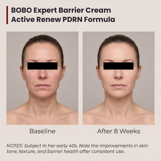 Time Reverse Madeca Cream — Advanced PDRN Formula
