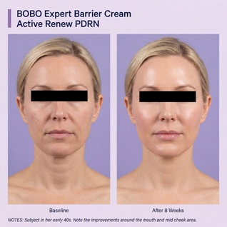 Firming Expert Madeca Cream — Advanced PDRN Formula