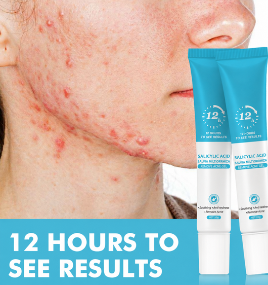 BOBO Effective repair acne scar anti-spot removal gel - VIP CLUB
